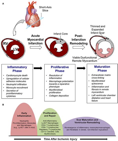 remodeling after myocardial infarction.